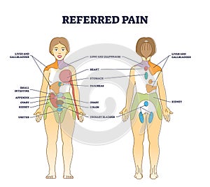 Referred pain location as body painful stimulus organ origin outline diagram photo