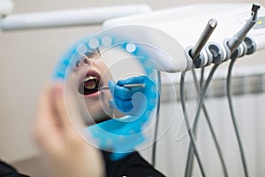 Reflection in the mirror mouth and teeth checkup of guy in a clinic