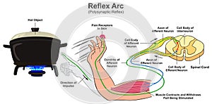 Reflex arc polysynaptic infographic diagram
