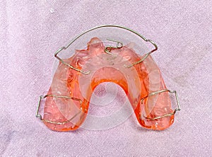 Removable dental appliance with spring for anterior crossbite patient photo