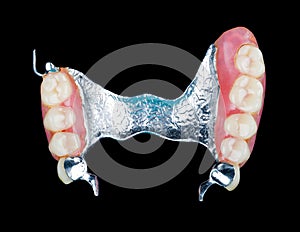 Removable dental prosthesis