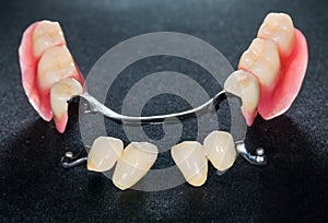 Removable dental prosthesis