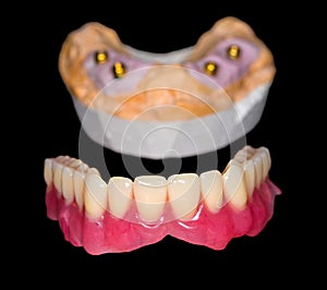 Removable denture photo