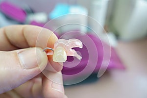 Removable denture in the hands of a doctor