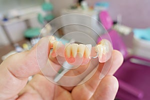 Removable denture in the hands of a doctor