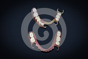 Removable dentures flexible, devoid of nylon, hypoallergenic exempt from monomer. photo