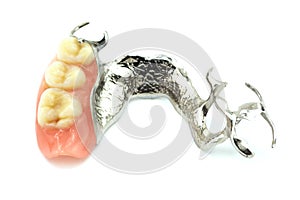 Removable partial denture