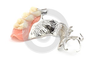 Removable partial denture photo