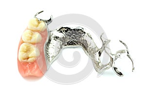 Removable partial denture photo