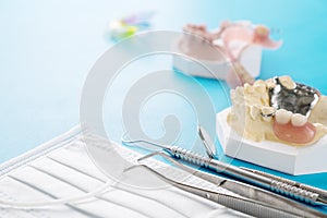 Removable partial denture RPD.