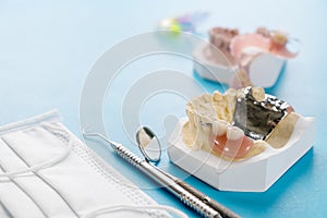 Removable partial denture RPD.