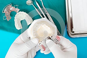 Removable partial denture RPD.