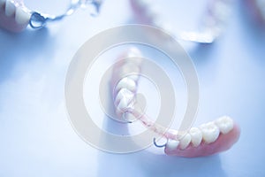 Removable partial dentures photo