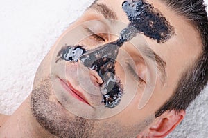 Removal of black dots on a man`s face with a black mask with activated charcoal