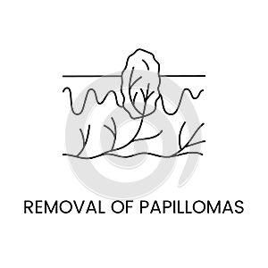 Removal of papillomas line icon in vector, illustration of papilloma in skin layers