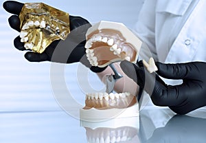 Removal of a tooth. Dentist doctor shows tooth structure. Dental layout. Dental implant. The doctor holds a tooth in black gloves