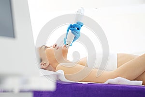 Removing acne scars by laser