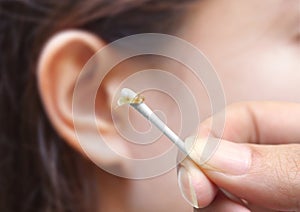 Removing ear wax