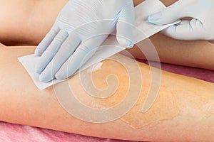 Removing unnecessary hair on the legs. Procedure sugaring in a beauty salon.Depilatory sugar paste