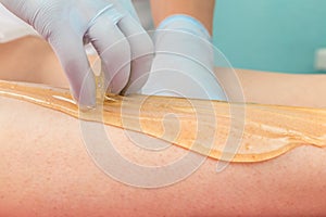 Removing unnecessary hair on the legs. Procedure sugaring in a beauty salon.Depilatory sugar paste