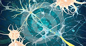 Remyelination is the phenomenon in which new myelin sheaths are