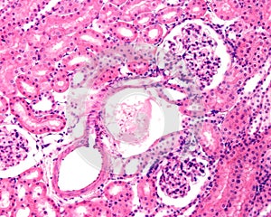 Renal cortex. Afferent arteriole