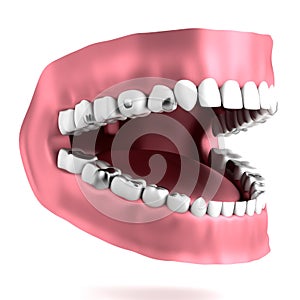 Render of human teeth with fillings