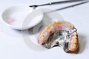Repair broken partial denture