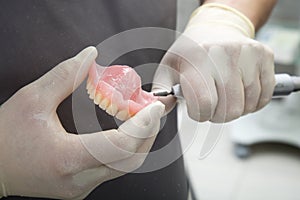 Repair of the upper jaw prosthesis insertion photo