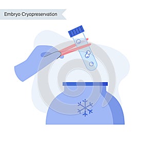 Reproductive system concept