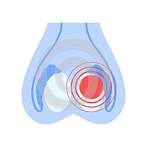 Reproductive system concept