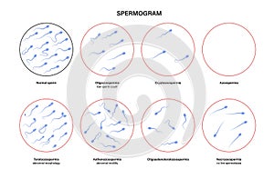 Reproductive system concept