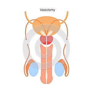 Reproductive system concept