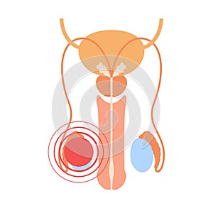 Reproductive system concept