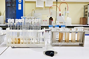 Research of biological material in biochemical laboratory