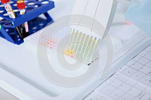 Research in the clinical and diagnostic laboratory. Pipette close-up. The concept of healthcare. Testing and development of the