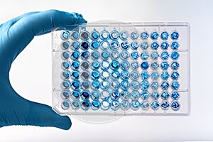 Researcher holding microplate for biomedical research photo