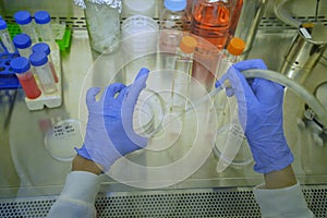 The researcher used the Glass Pasteur Pipette for aspirating culture media from culture dish 100 mm diameter by sterile method. photo