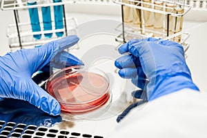 Researcher working with petri plate in a microbiology laboratory. In the background are test tubes with multi-colored