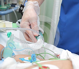 Respiratory care under the doctors supervision in the ICU