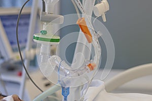 Respiratory connection tube, HME filter, carbon dioxide sensor and suction catheter, patient connected to medical ventilator in