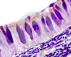 Respiratory epithelium. Goblet cells photo