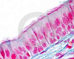 Respiratory epithelium photo