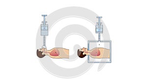 Respiratory system of human the anatomy of airways. Principle of artificial lung ventilation by positive and negative pressure