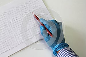 Results of an electroencephalogram after a neurophysiological examination, which is the recording of brain bioelectric activity at