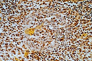 Reticular cell is a type of fibroblast. They are found in many tissues including the spleen, lymph nodes and lymph nodules photo
