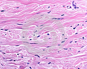 Reticular dermis. Human skin