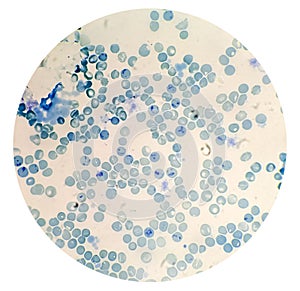 Reticulocyte count under microscope, 40x. methylene blue staining