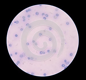 Reticulocytes photo