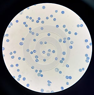 Reticulocytes is red blood cell immature photo